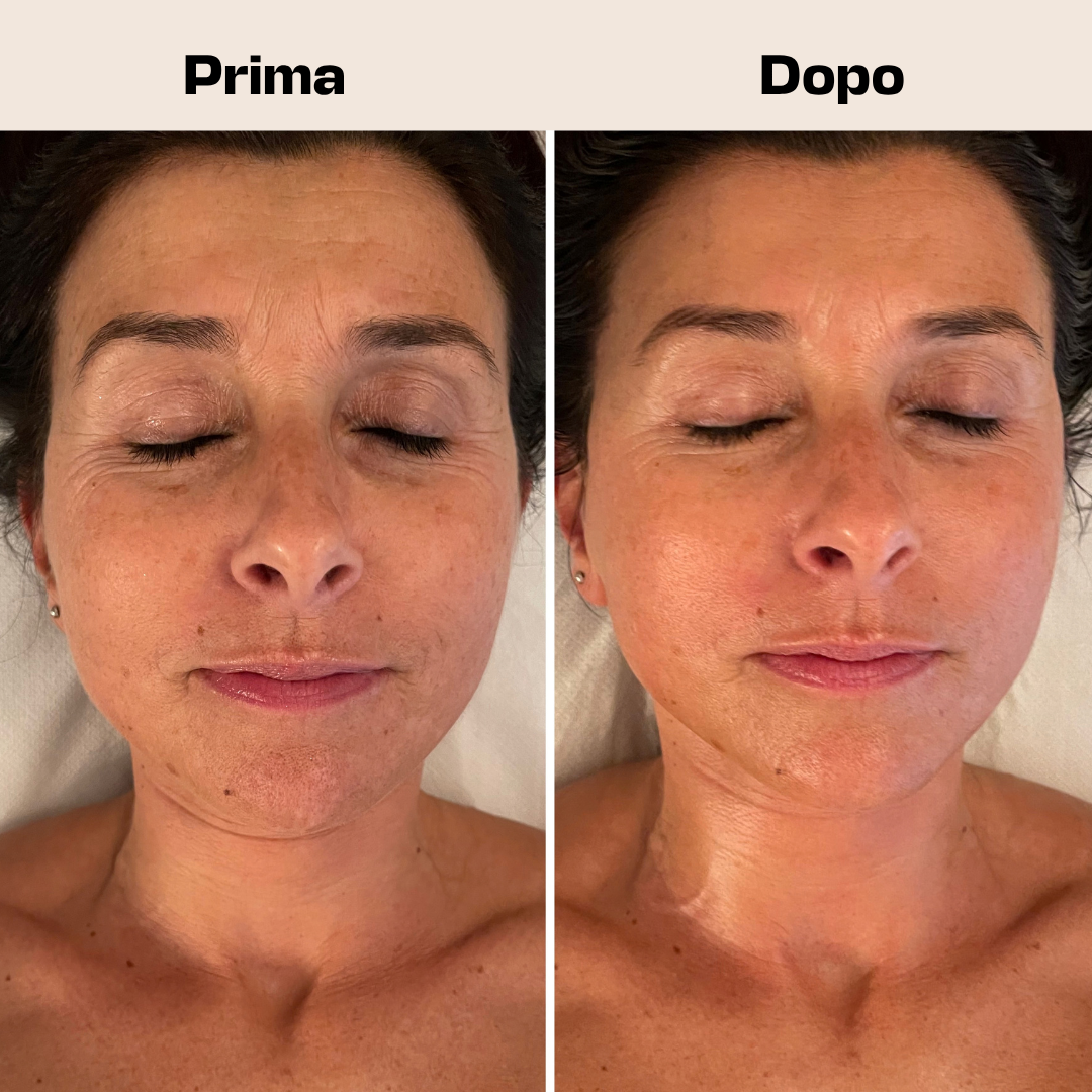Gua Sha
