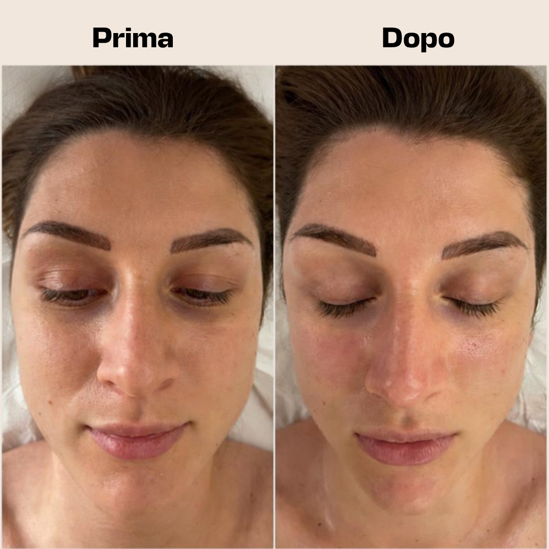 Gua Sha